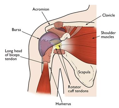 Common Shoulder Conditions And How To Treat Them - Welcare Hospital