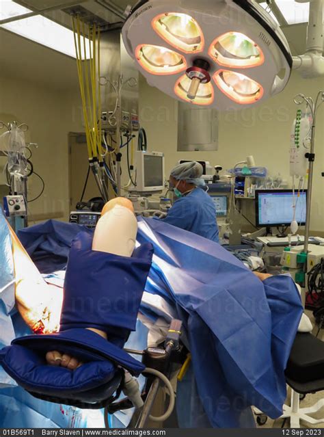 Anesthesia Lithotomy 的图像结果