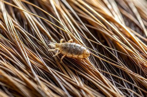 Scalp Parasites 的图像结果