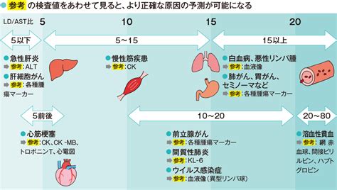 LD（乳酸脱水素酵素）の読み方｜「細胞傷害」を読む検査 | 看護roo![カンゴルー]