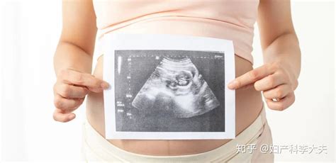 孕期如何计算胎儿体重？ - 知乎