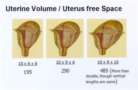 Measuring Uterus Quantitative Ultrasound Measurement Of Uterine