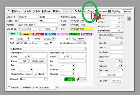 Image result for SoftDent Tutorial