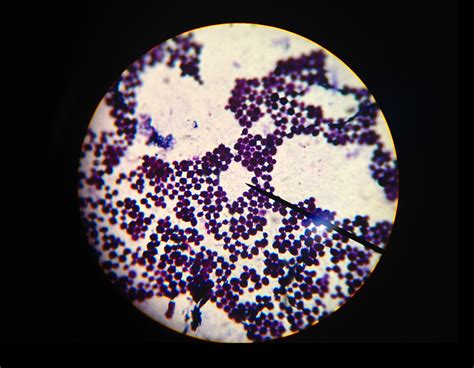 Staphylococcus Aureus Under Microscope 的图像结果