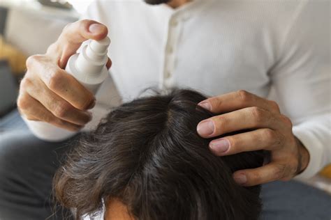 Hair Loss Drug Minoxidil Under Scrutiny Over Risks to Infants and Eye ...