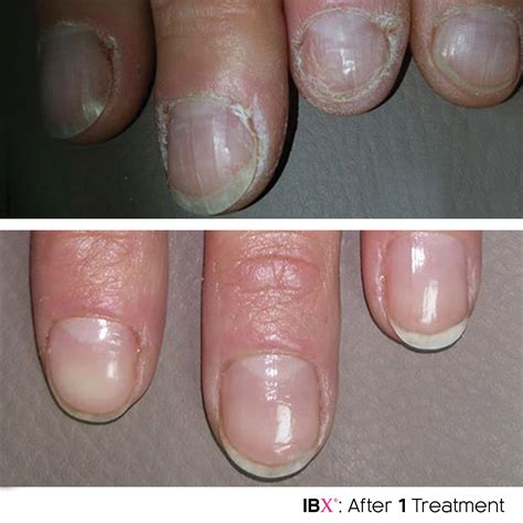IBX Nail Treatment - Beauty by Leanne Musselburgh