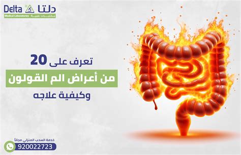 تعرف على 20 من أعراض الم القولون وكيفية علاجه