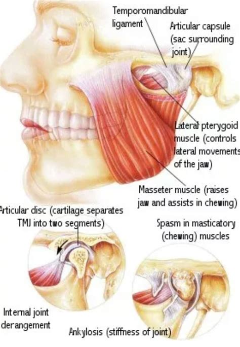Tmj Neck Pain