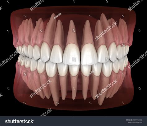 3,736 Canine Tooth Humans Images, Stock Photos & Vectors | Shutterstock