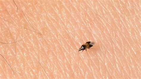What Are These Tiny Black Bugs In My House That Bite | Psoriasisguru.com