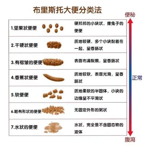 婴儿便便的种类及健康判断 - 知乎