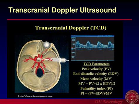 PPT - Introduction to Carotid Ultrasound and Transcranial Doppler ...