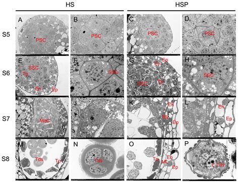 Abnormal Calcium Accumulation and ROS Homeostasis-Induced Tapetal ...