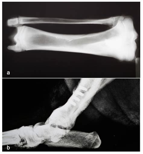 Role of rhBMP-7, Fibronectin, And Type I Collagen in Dental Implant ...