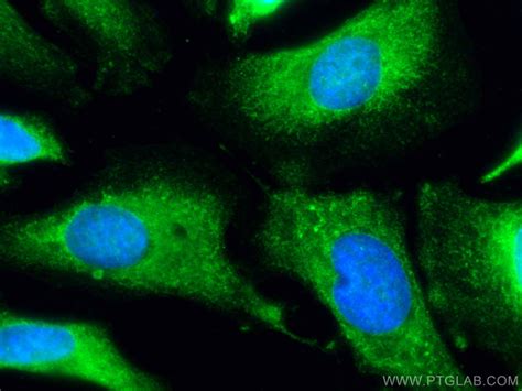 COX-1/Cyclooxygenase-1 antibody (CL488-67346) | Proteintech