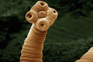 Image result for tapeworm in commercial red meat