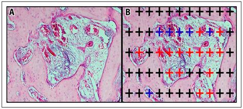 Effects of NGF and Photobiomodulation Therapy on Crush Nerve Injury and ...