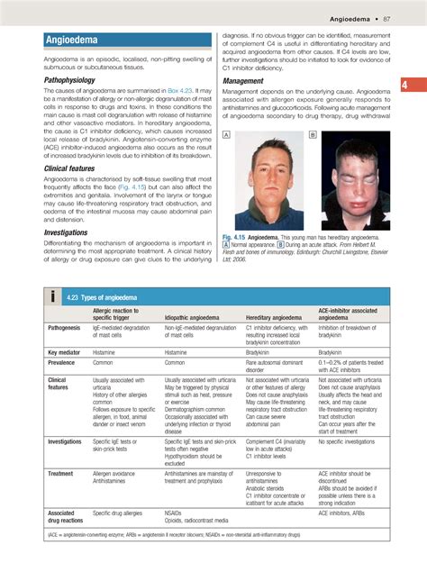 Split PDFFile 106 to 111 - Angioedema • 87 4 diagnosis. If no obvious ...