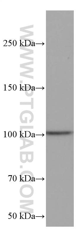 RIAM antibody (67143-1-Ig) | Proteintech