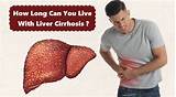 लिवर सिरोसिस | लिवर सिरोसिस को कैसे ठीक करे |लिवर सिरोसिस को कैसे ठीक ...