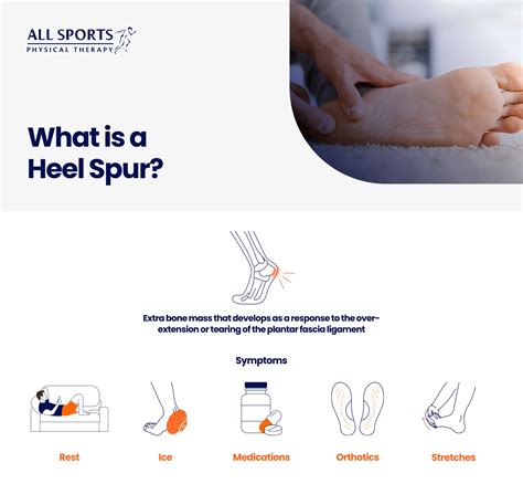 What is a Heel Spur?