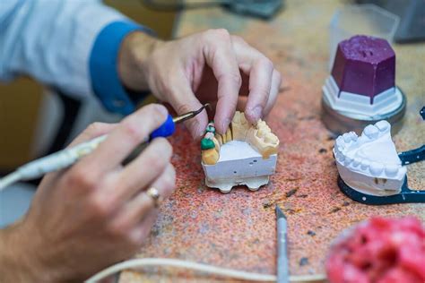 Homemade Dental Bridge 的图像结果