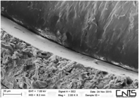 Comparison of Two Root Canal Filling Techniques: Obturation with ...