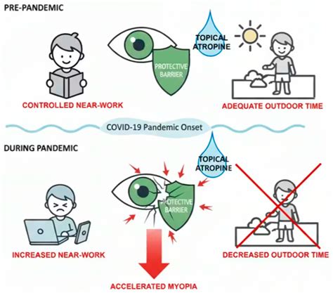 Myopic Progression Associated with COVID-19 Pandemic in Korean Children ...