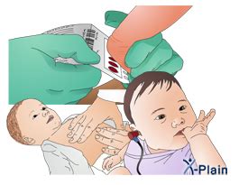 Image result for Fetalscreen II