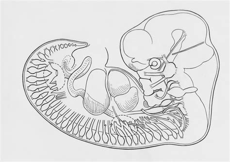 Image result for Neural Tube Defects Causes