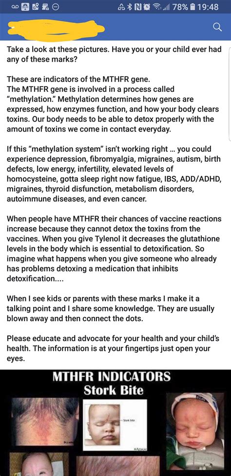 Sugar Bug Vein Causes And How To Support The Baby, 53% OFF