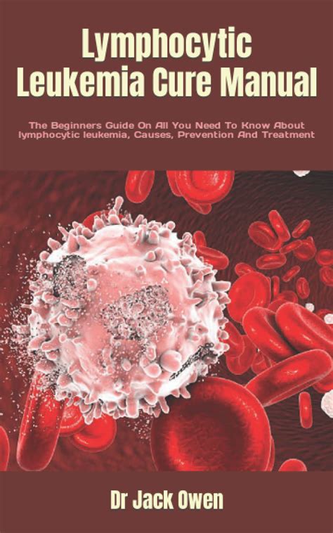 Buy Lymphocytic Leukemia Cure Manual: The Beginners Guide On All You ...