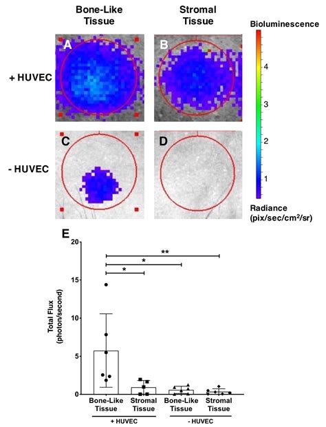 In Vitro Prevascularization of Self-Assembled Human Bone-Like Tissues ...