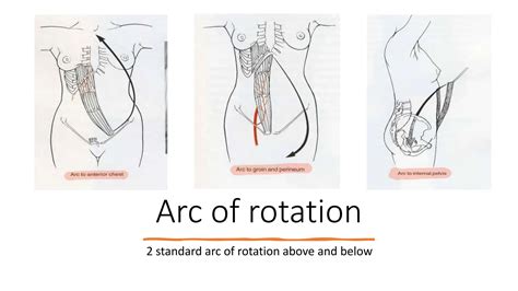 TRAM - Modified TRAM , DIEP Flap - for Breast reconstruction | PPTX