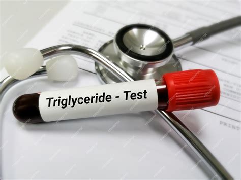 Premium Photo | Blood sample for triglyceride test. lipid profile. heart failure.