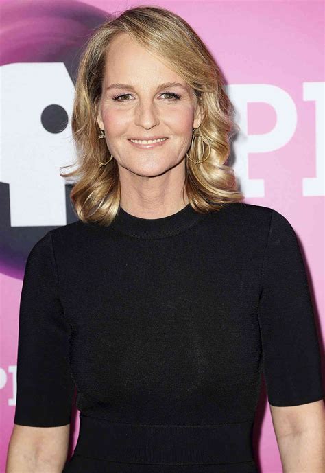 Helen Hunt Plastic Surgery Bad