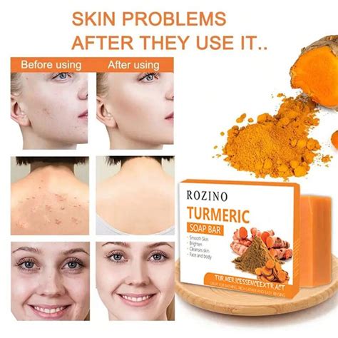 100g Turmeric Soap: Facial & Body Cleanse, Brighten Skin Tone, Deep ...