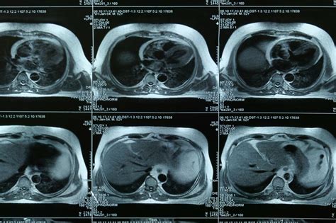 Image result for Inner Imaging Body Scan