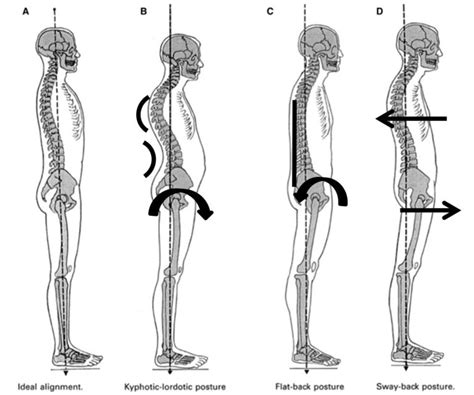 Image result for Normal Posture