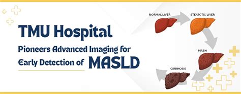 Role of Digital Mammography in Early Breast Cancer Detection