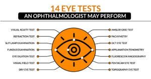 Image result for Eye ROM Test