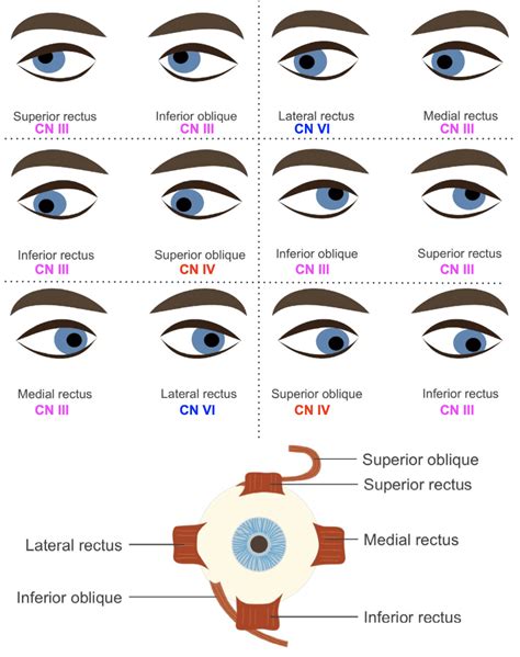 Fourth Cranial Nerve Lesions • LITFL • FFS
