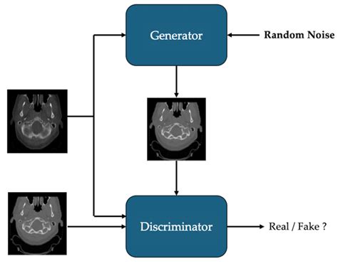 Deep Learning for CT Synthesis in Radiotherapy