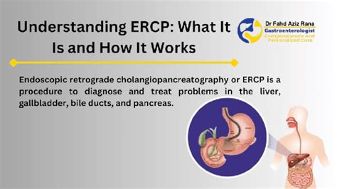ERCP Procedure | Understanding Diagnosis and Treatment