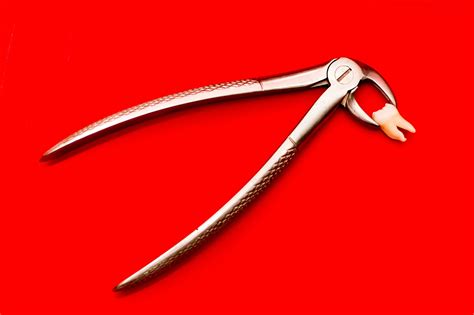 Image result for Tooth Extraction Procedure