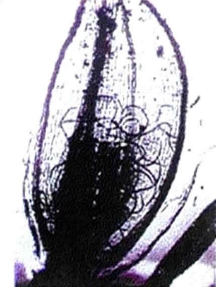 TNAU Agritech Portal :: Crop Protection