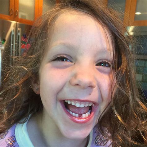 Image result for First Loose Tooth Getting Pulled Out