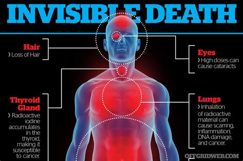 Radiation Poisoning Effects On Human