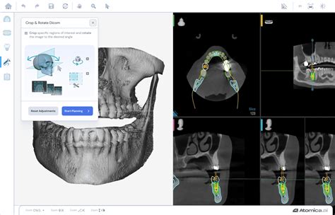 Image result for Atomica Software Arabic Tutorial