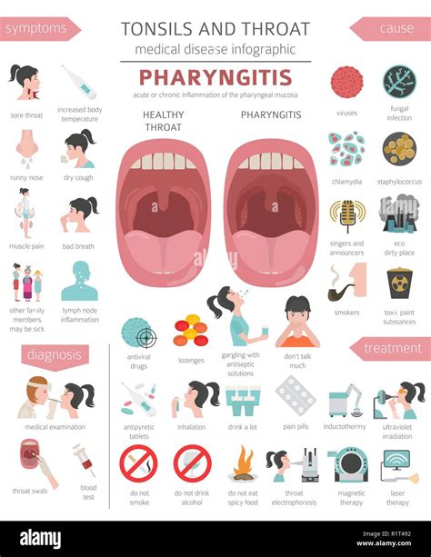 Tonsils and throat diseases. Pharyngitis symptoms, treatment icon set. Medical infographic ...